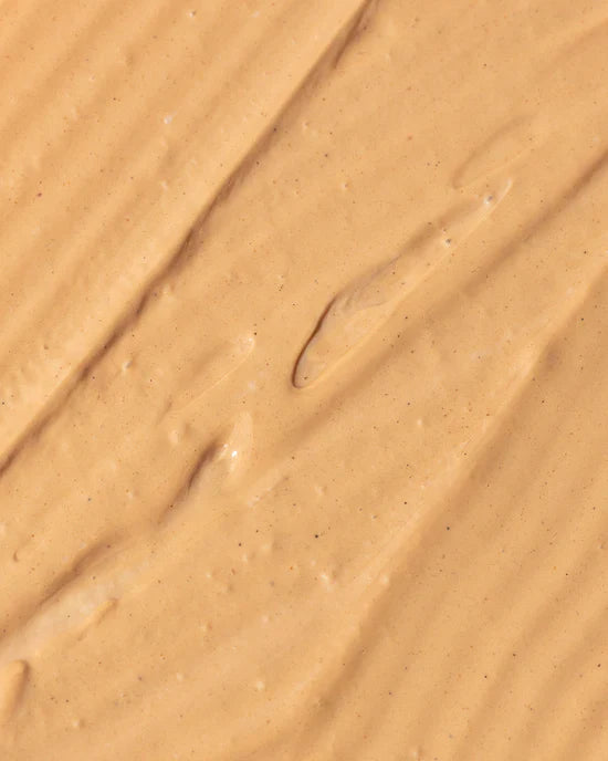 Hyperpigemnation/ Melasma